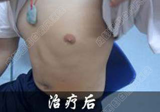 成都白癜风哪个医院好