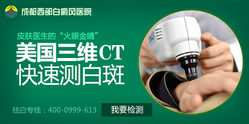 成都白癜风哪个医院好