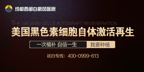 成都白癜风哪个医院好