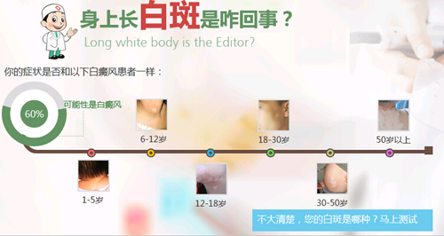 成都白癜风哪个医院好