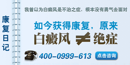 成都白癜风哪个医院好